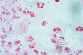 Unknown disease spreads in North-West Floresia